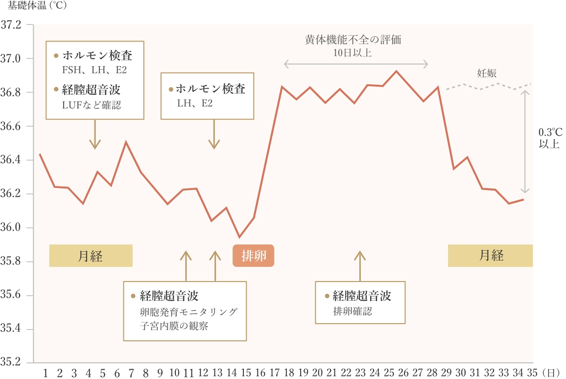 月経周期における基礎体温（BBT）の変化と、それに合わせて行われる不妊検査・経過観察の推奨されるタイミングを示したグラフ。月経期にホルモン検査（FSH, LH, E2）を、低温期中盤に経膣超音波で卵胞を観察し、高温期で黄体機能を評価するサイクルが示されている。